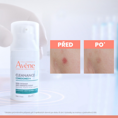 Avène Cleanance ComedoMed starostlivosť 30 ml