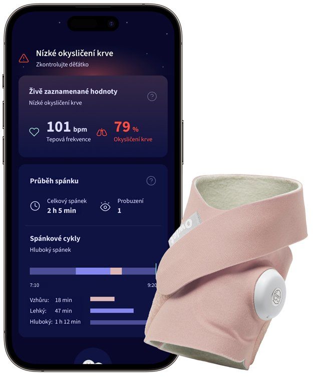 Owlet Ponožka inteligentná Dream Sock - matne ružová 1 ks