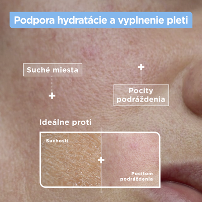 Mixa Hyaluronic Acid + Lactic Acid, Hydratačné pleťové sérum 30 ml