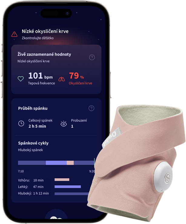 Owlet Ponožka inteligentná Dream Sock - matne ružová 1 ks