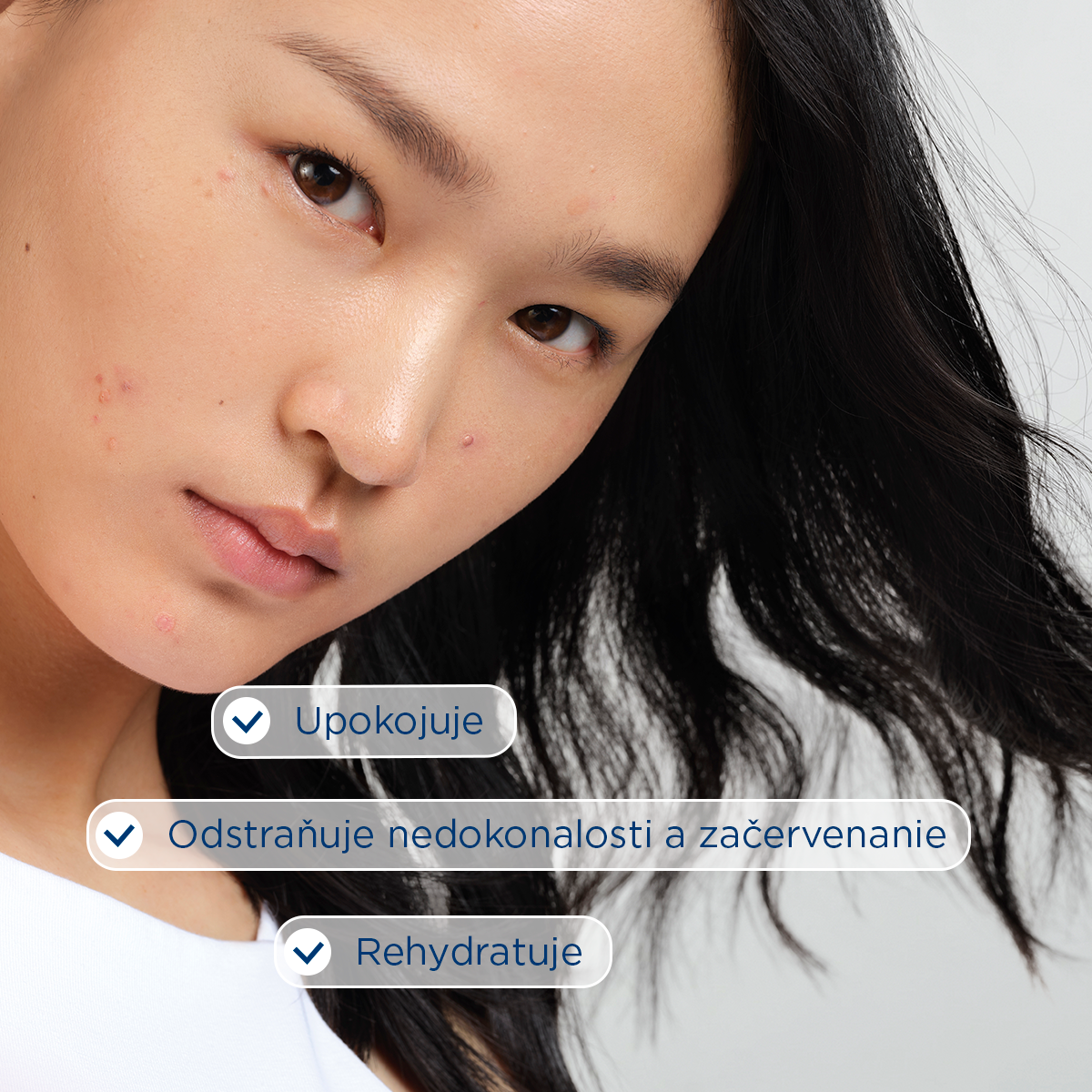 Bioderma Sébium Sensitive upokojujúci a hydratačný krém na pleť s akné 30 ml